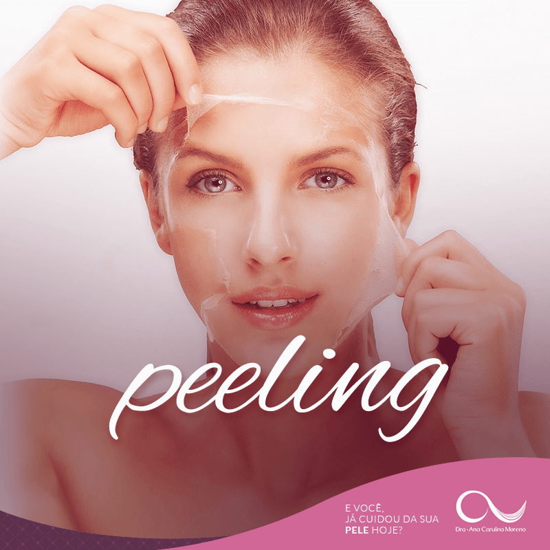 Peeling em jacarepagua