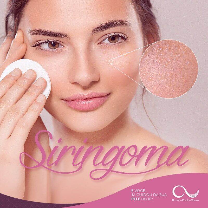 Siringoma
