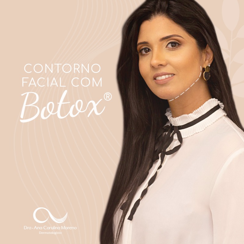 Botox full face