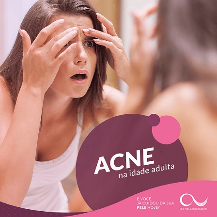 dermatologista especialista em acne