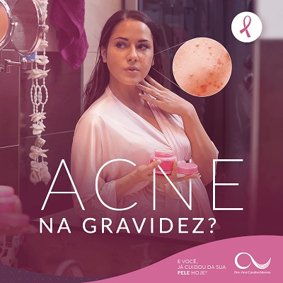 acne no rj