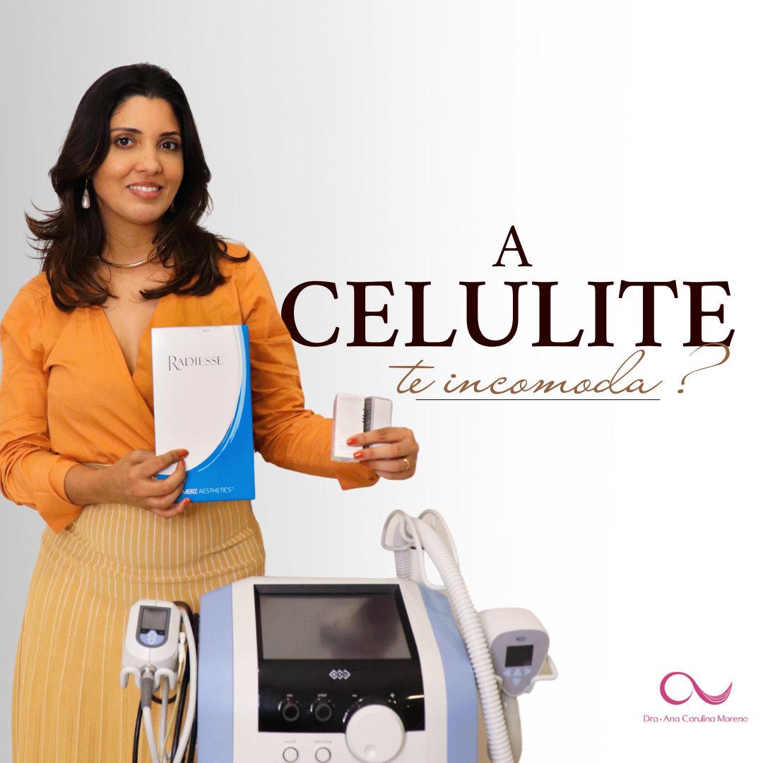 Os 6 Melhores Tratamentos para Celulites - Dra. Ana Carulina Moreno