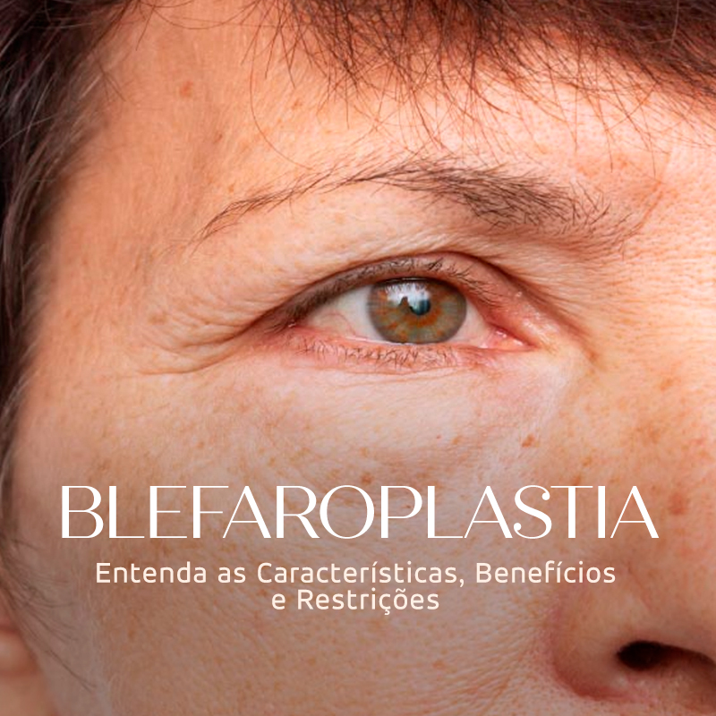 Blefaroplastia: Rejuvenesça o Olhar com Naturalidade