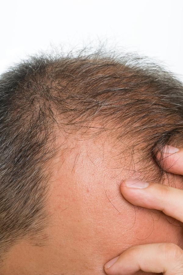 estética para homens