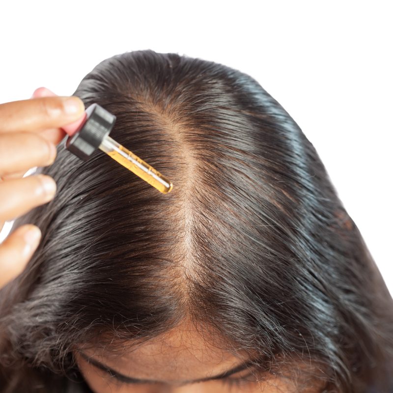 Minoxidil