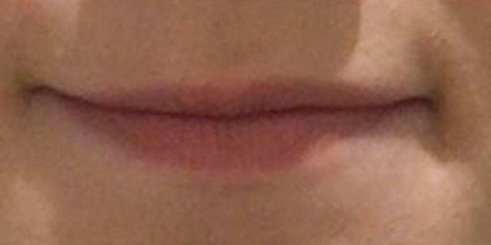 Antes 2