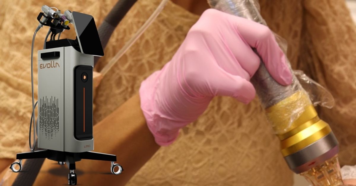 Guia Completo sobre a Radiofrequência MonoPolar Evolla